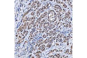 IHC analysis of SCML1 using anti-SCML1 antibody (ABIN7602479). (SCML1 anticorps  (AA 8-322))