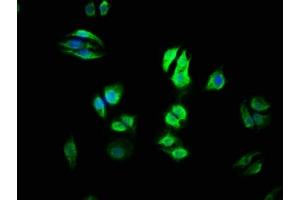 Immunofluorescence staining of HepG2 cells with ABIN7174989 at 1:100, counter-stained with DAPI.