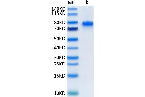 Mouse CD40 Ligand Trimer on Tris-Bis PAGE under reduced condition. (CD40 Ligand Protein (CD40LG) (Trimer) (Fc Tag))