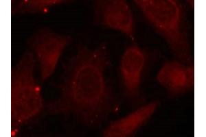 Immunofluorescence staining of methanol-fixed Hela cells using Merlin(Phospho-Ser518) Antibody. (Merlin anticorps  (pSer518))
