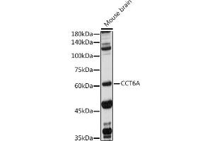 Western blot analysis of extracts of Mouse brain, using CCT6A antibody (ABIN1679063, ABIN3017847, ABIN3017849 and ABIN6220290) at 1:1000 dilution. (CCT6A anticorps  (AA 80-250))