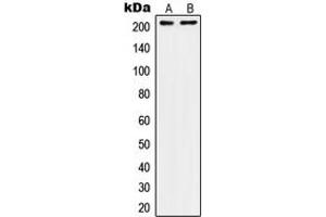 Western blot analysis of CD104 expression in A431 (A), SW480 (B) whole cell lysates. (Integrin beta 4 anticorps  (C-Term))