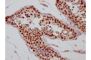 IHC image of ABIN7127630 diluted at 1:100 and staining in paraffin-embedded human testis tissue performed on a Leica BondTM system.