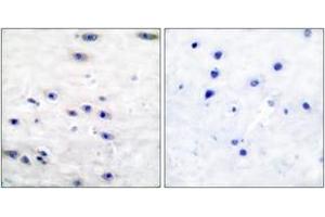 Immunohistochemistry (IHC) image for anti-Tyrosine Hydroxylase (TH) (AA 10-59) antibody (ABIN2888583) (Tyrosine Hydroxylase anticorps  (AA 10-59))