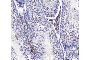 IHC analysis of SMC6L1 using anti-SMC6L1 antibody (ABIN5693133). (SMC6 anticorps  (AA 205-443))