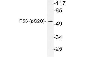 Western blot (WB) analysis of p-P53 antibody in extracts from COS7 cells. (p53 anticorps  (pSer20))