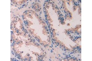 Used in DAB staining on fromalin fixed paraffin- embedded Kidney tissue (SCUBE3 anticorps  (AA 807-993))