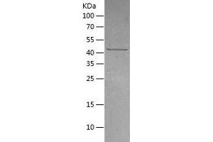 Western Blotting (WB) image for Tubulin Folding Cofactor E-Like (TBCEL) (AA 1-424) protein (His-IF2DI Tag) (ABIN7125520)