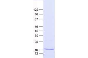 Validation with Western Blot