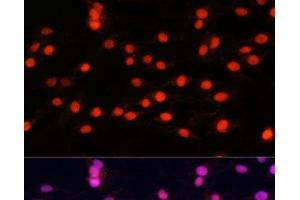 Immunofluorescence analysis of C6 cells using ZNF433 Polyclonal Antibody at dilution of 1:100 (40x lens). (ZNF433 anticorps)