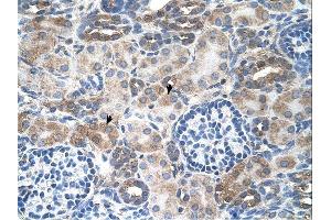 SLC14A1 antibody was used for immunohistochemistry at a concentration of 4-8 ug/ml.