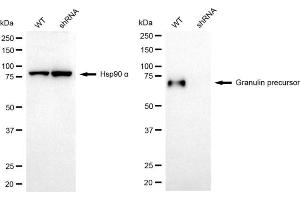 Western blotting analysis using granulin precursor antibody (ABIN7798800).