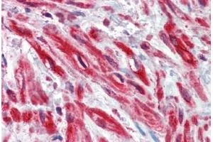 Human Prostate, stroma: Formalin-Fixed, Paraffin-Embedded (FFPE)