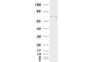 Validation with Western Blot