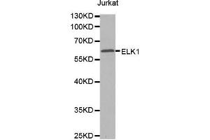Western blot analysis of extracts of Jurkat cells tissue, using ELK1 antibody.