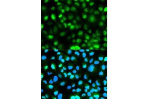 Immunofluorescence analysis of HeLa cells using ATXN3 antibody. (Ataxin 3 anticorps  (AA 1-364))