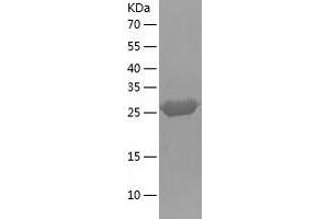 Western Blotting (WB) image for Enoyl Coenzyme A Hydratase 1, Peroxisomal (ECH1) (AA 34-328) protein (His tag) (ABIN7122793) (ECH1 Protein (AA 34-328) (His tag))