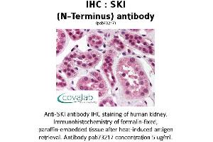 Image no. 2 for anti-SKI Proto-Oncogene (SKI) antibody (ABIN1739312) (SKI anticorps)