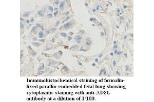 Image no. 1 for anti-Adenylosuccinate Lyase (ADSL) antibody (ABIN1574515)