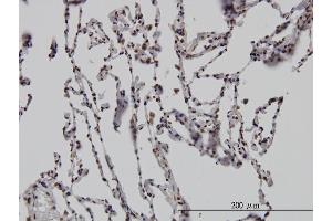 Immunoperoxidase of monoclonal antibody to DLX2 on formalin-fixed paraffin-embedded human lung. (DLX2 anticorps  (AA 1-110))