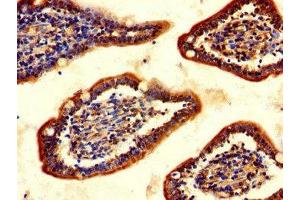 Immunohistochemistry of paraffin-embedded human small intestine tissue using ABIN7147620 at dilution of 1:100 (Choline Acetyltransferase anticorps  (AA 354-592))
