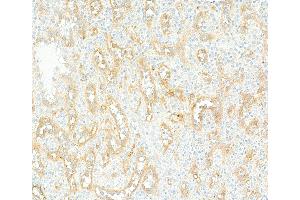 Immunohistochemistry (IHC) image for anti-CD36 (CD36) (AA 30-439) antibody (ABIN7449417) (Recombinant CD36 anticorps  (AA 30-439))