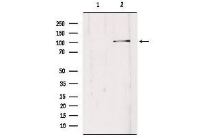 Western blot analysis of extracts from Hepg2, using EDEM3 Antibody. (EDEM3 anticorps  (C-Term))