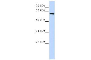 SPAG8 antibody used at 1 ug/ml to detect target protein. (SPAG8 anticorps  (Middle Region))
