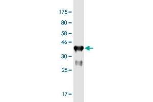 Western Blot detection against Immunogen (37. (FBXO43 anticorps  (AA 1-110))