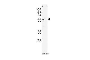 Western blot analysis of CYP3A4 Antibody in NCI-H460 cell line lysates (35ug/lane)