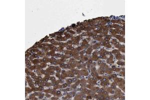 Immunohistochemical staining of human liver with PYGL polyclonal antibody  shows strong cytoplasmic positivity in hepatocytes at 1:500-1:1000 dilution. (PYGL anticorps)