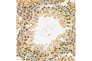Immunohistochemistry analysis of paraffin embedded rat testis using MASTL (ABIN7074616) at dilution of 1: 2100