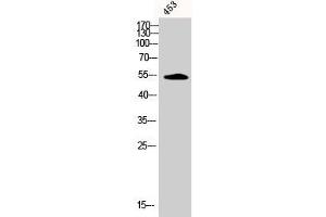 Western Blot analysis of 453 cells using Phospho-CaMKIIα/β/δ (T305) Polyclonal Antibody (CAMK2A anticorps  (pThr305))