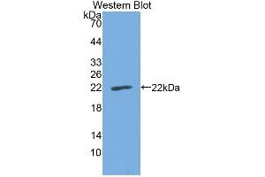 Western Blotting (WB) image for anti-Cell Division Cycle 25 (CDC25) (AA 376-524) antibody (ABIN1867137) (Cdc25 anticorps  (AA 376-524))