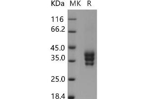 Western Blotting (WB) image for Endothelial Cell Adhesion Molecule (ESAM) protein (His tag) (ABIN7320087)