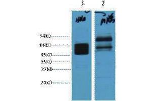 Western Blotting (WB) image for anti-Keratin 8 (KRT8) antibody (ABIN3178608) (KRT8 anticorps)