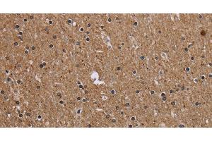 Immunohistochemistry of paraffin-embedded Human brain tissue using CMTM5 Polyclonal Antibody at dilution 1:40 (CMTM5 anticorps)