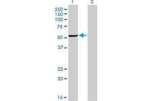 Western Blot analysis of MAK expression in transfected 293T cell line by MAK monoclonal antibody (M02), clone 4E9. (MAK anticorps  (AA 358-457))