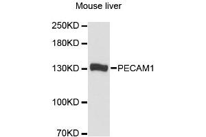 Western blot analysis of extracts of mouse liver, using PECAM1 antibody. (CD31 anticorps)