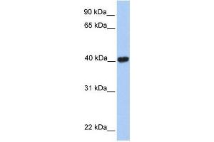 MGC29891 antibody used at 0. (GABPB2 anticorps  (C-Term))