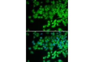 Immunofluorescence analysis of U20S cell using NCF4 antibody. (NCF4 anticorps  (AA 1-190))