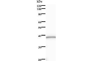 Western Blotting (WB) image for anti-SRY (Sex Determining Region Y)-Box 6 (SOX6) antibody (ABIN931254) (SOX6 anticorps)