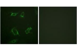 Immunofluorescence analysis of HepG2 cells, using PLD1 (Phospho-Ser561) Antibody. (PLD1 anticorps  (pSer561))