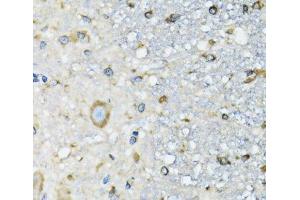 Immunohistochemistry of paraffin-embedded Mouse spinal cord using DARS Polyclonal Antibody at dilution of 1:100 (40x lens).