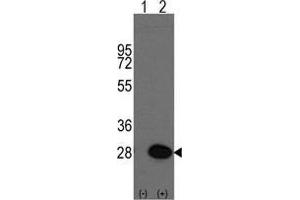Western blot analysis of HSPB1(arrow) using rabbit polyclonal HSPB1 Antibody (HSP27 anticorps  (Ser83))