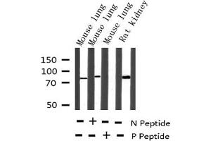 Western blot analysis of Phospho-C-RAF (Ser621) expression in various lysates