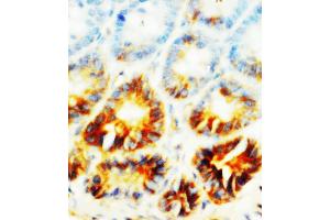 Anti-Alkaline Phosphatase antibody, IHC(P) IHC(P): Rat Small Intestine Tissue (ALPL anticorps  (N-Term))