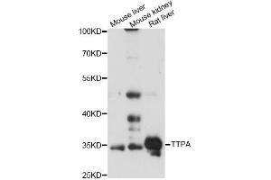 Western blot analysis of extracts of various cell lines, using TTPA antibody (ABIN6293751) at 1:3000 dilution. (TTPA anticorps)