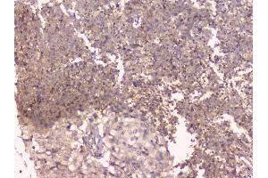 IHC analysis of TNFRSF11B using anti-TNFRSF11B antibody (ABIN7600875).