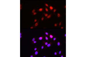 anti-HOP Homeobox (HOPX) (AA 1-73) antibody